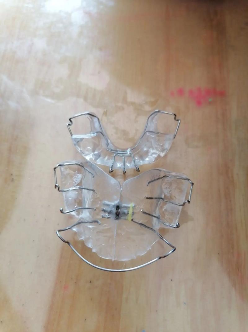牙齿矫正器什么牌的好?热门品牌优缺点对比及选购建议-图1 牙齿矫正器什么牌的好?热门品牌优缺点对比及选购建议-图1