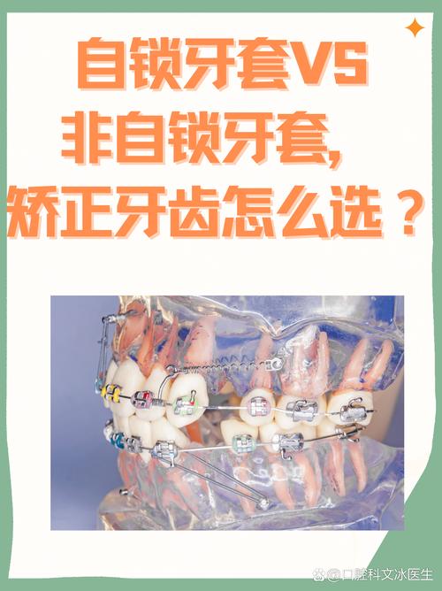 自锁托槽牙齿矫正疼吗？过程疼痛程度如何缓解？-图2