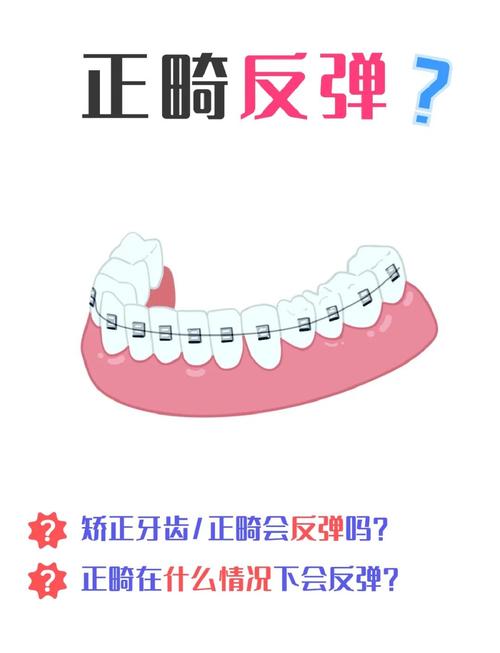 矫正后牙齿反弹怎么办？科学应对防复发！-图1