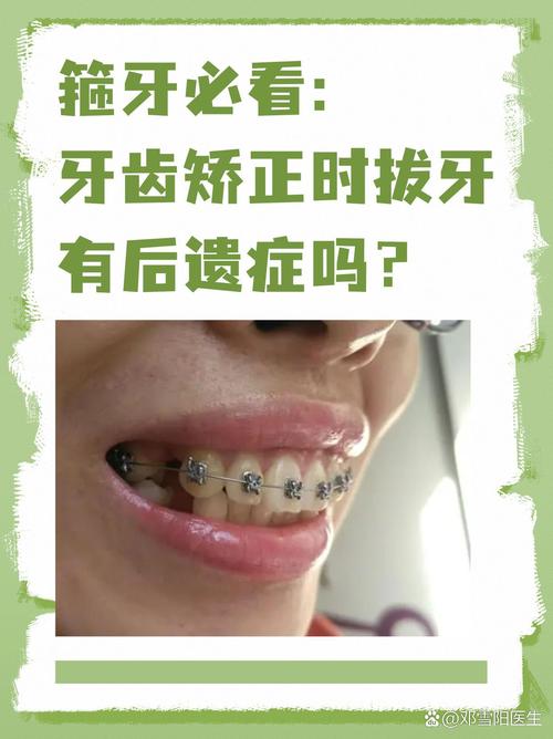 成年人矫正牙齿,这些后遗症你了解多少?-图2 成年人矫正牙齿,这些后遗症你了解多少?-图2