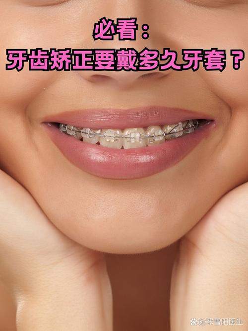 牙齿锁合矫正一般需要多久完成？-图1