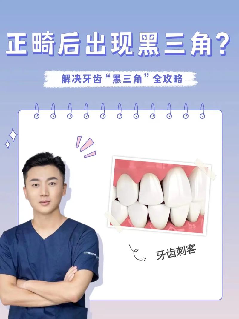 矫正牙齿黑三角是什么？-图2