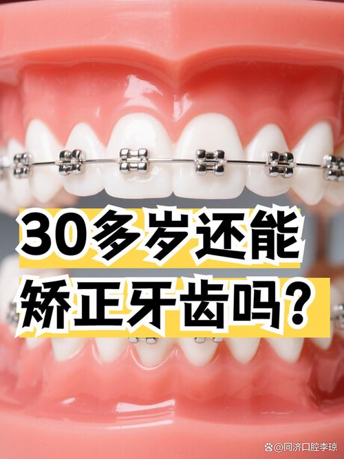 三十岁矫正牙齿还来得及吗？-图2