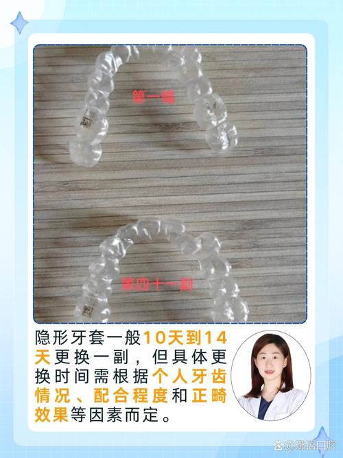 矫正中途换隐适美可行?效果会受影响吗?-图1 矫正中途换隐适美可行?效果会受影响吗?-图1