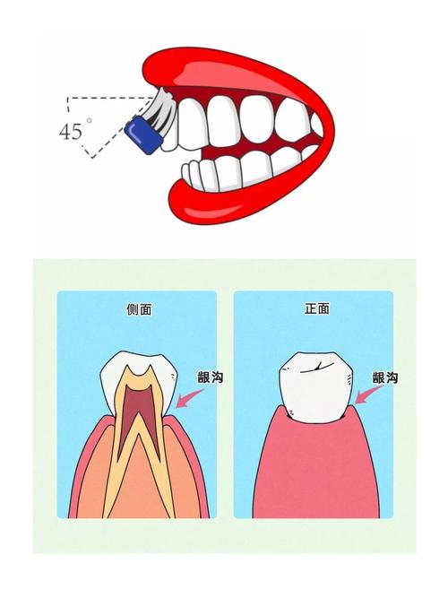 矫正牙齿后，一天究竟要刷几次牙才够？-图1