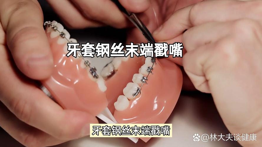 矫正牙齿钢丝总戳嘴，到底该怎么处理？-图1