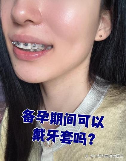 备孕可以做牙齿矫正吗-图2