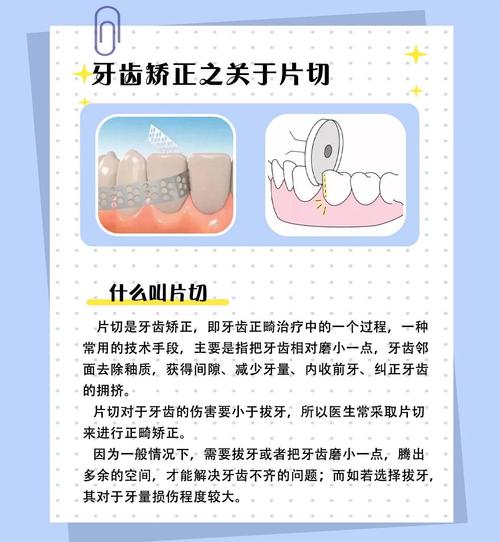 矫正牙齿有缝隙怎么办？这样处理效果好！-图3