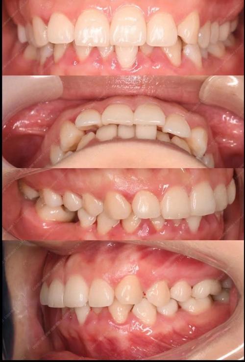 杭州市矫正牙齿去哪里-图2