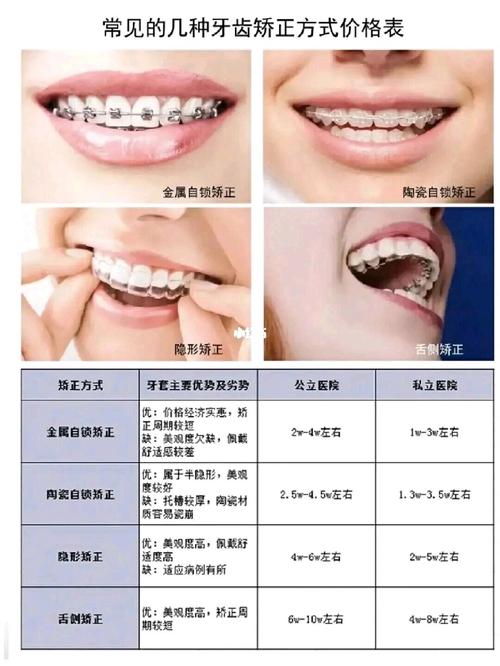 大连矫正牙齿费用多少？不同矫正方式价格差异大吗？-图2