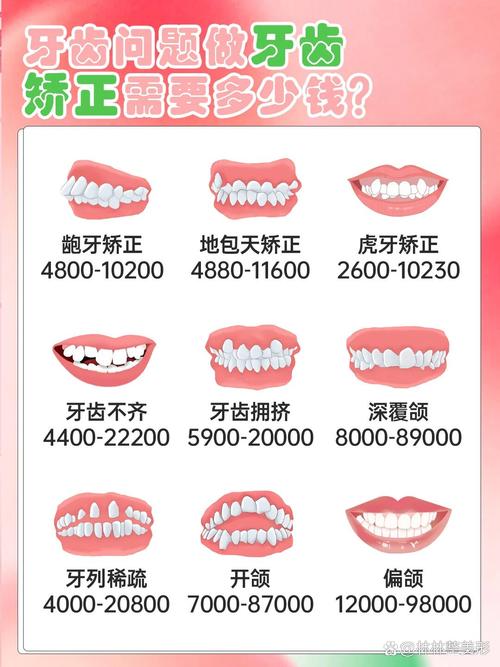 20岁矫正牙齿费用要多少？不同情况费用差多少？-图2