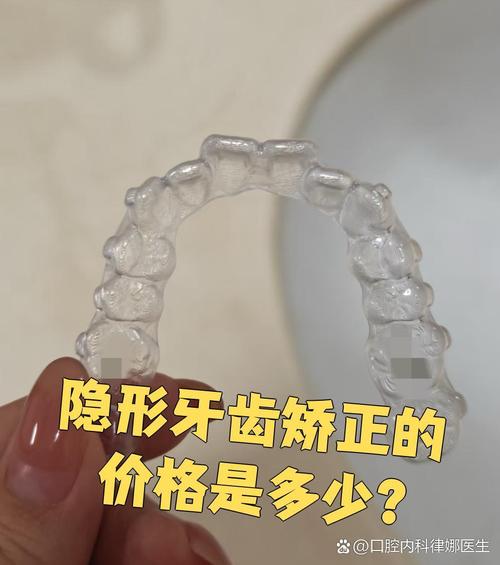 无托槽隐形牙齿矫正术-图2