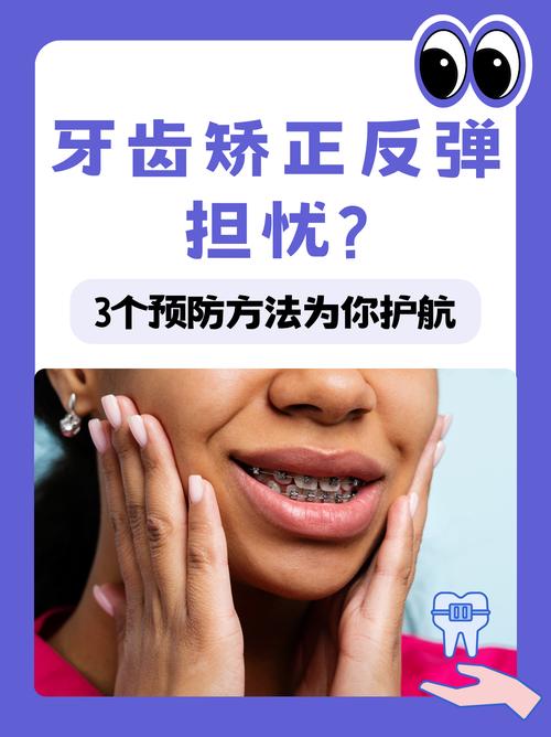 牙齿矫正后反弹，原因究竟是什么？-图3
