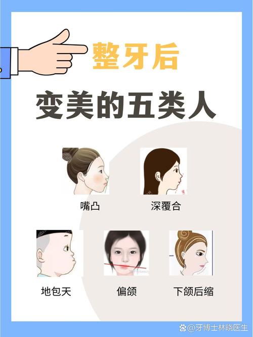 牙齿矫正可以改变鼻子-图2