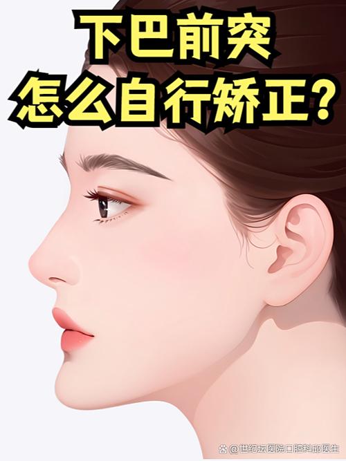 矫正牙齿下巴会变尖吗？-图1