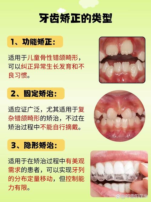 门牙烤瓷牙矫正牙齿吗-图2