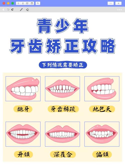 牙齿咬合矫正的最佳年龄是多少?-图1 牙齿咬合矫正的最佳年龄是多少?-图1