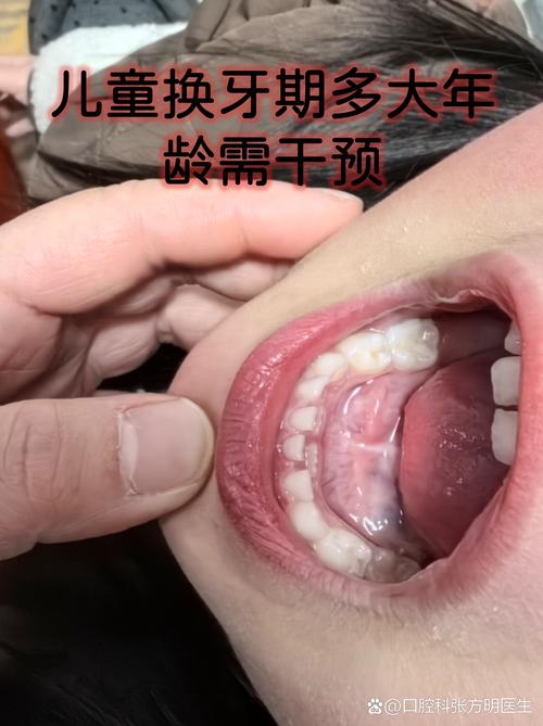 牙齿没换完能矫正吗？-图1