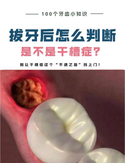 牙齿矫正拔牙后遗症吗-图2