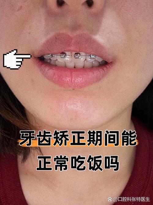 想矫正牙齿老公不同意，这问题到底该怎么处理？-图3
