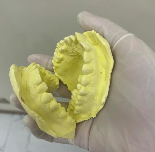 矫正牙齿做牙模要多久-图3