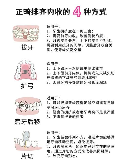 矫正牙齿时，内收一般在哪个阶段进行最合适？-图1