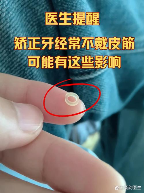 矫正橡皮筋误吃了会怎样？需要处理吗？-图1