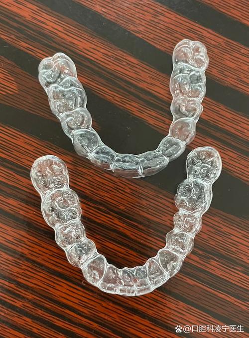 隐形矫正器效果如何?与传统矫正有何不同?-图1 隐形矫正器效果如何?与传统矫正有何不同?-图1