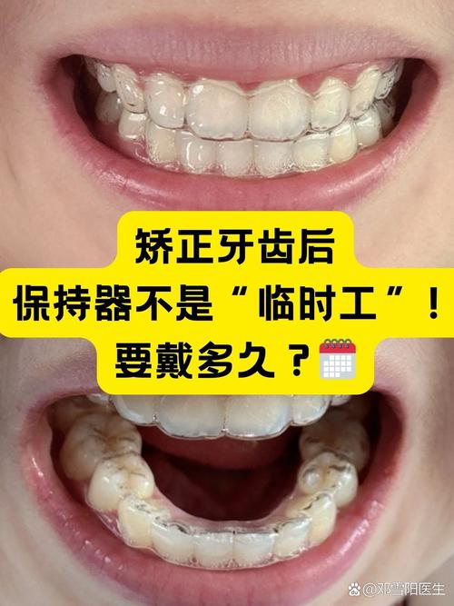 初中生矫正牙齿要多久?不同错颌畸形矫正时长有何差异?-图3 初中生矫正牙齿要多久?不同错颌畸形矫正时长有何差异?-图3