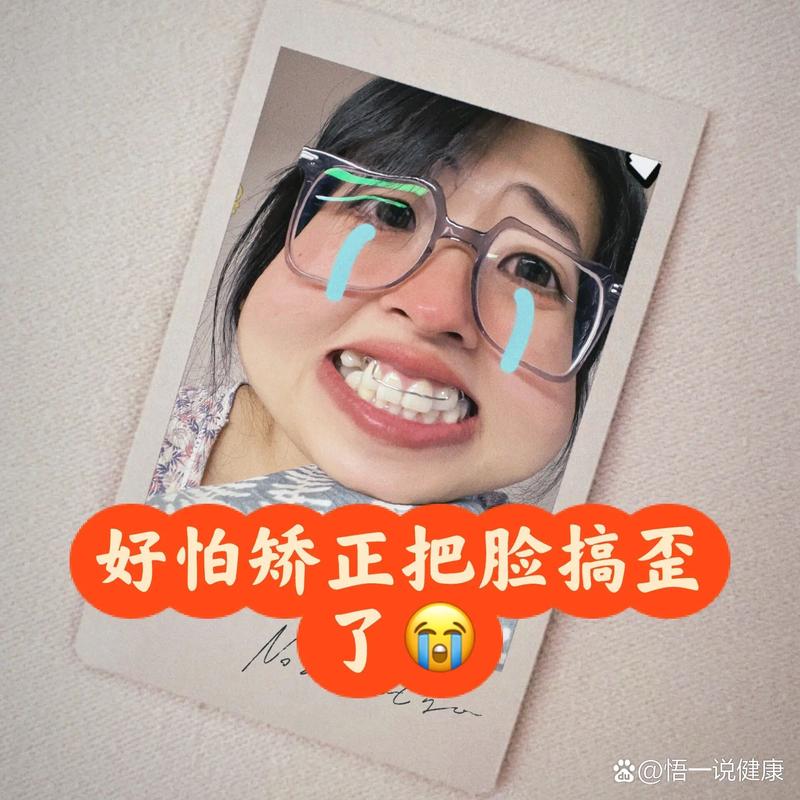 矫正牙齿真的会导致嘴歪吗？-图2