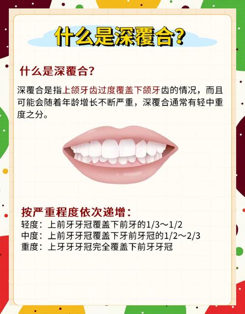 牙齿深覆合矫正一般需要多久?-图1 牙齿深覆合矫正一般需要多久?-图1