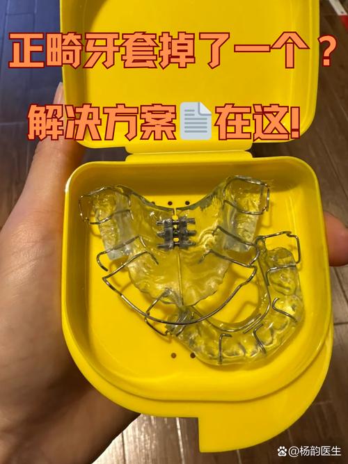 兜齿自己矫正可行吗？家庭操作的方法与注意事项有哪些？-图2