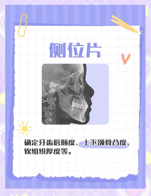 矫正牙齿要拍哪些片子？不同片子的检查重点是什么？-图1