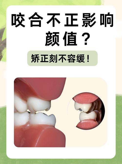 牙齿矫正会影响脸型么-图2 牙齿矫正会影响脸型么-图2