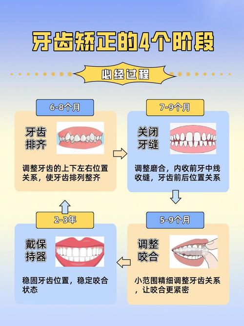 牙齿矫正过程视频大全包含哪些关键步骤？-图1