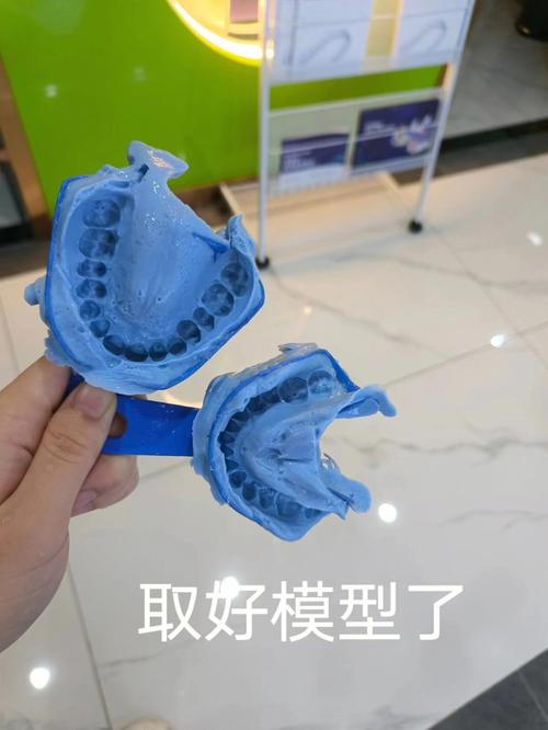 牙齿矫正后不带保持器，矫正效果真的会反弹回原样吗？-图2