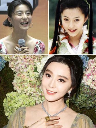 范冰冰牙齿矫正图片引热议，矫正效果究竟如何？-图1