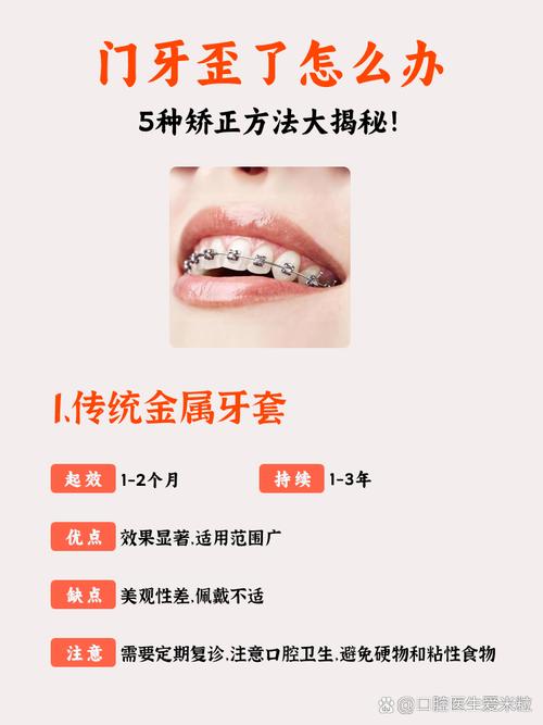 大门牙矫正牙齿会有哪些潜在的健康危害?-图2 大门牙矫正牙齿会有哪些潜在的健康危害?-图2