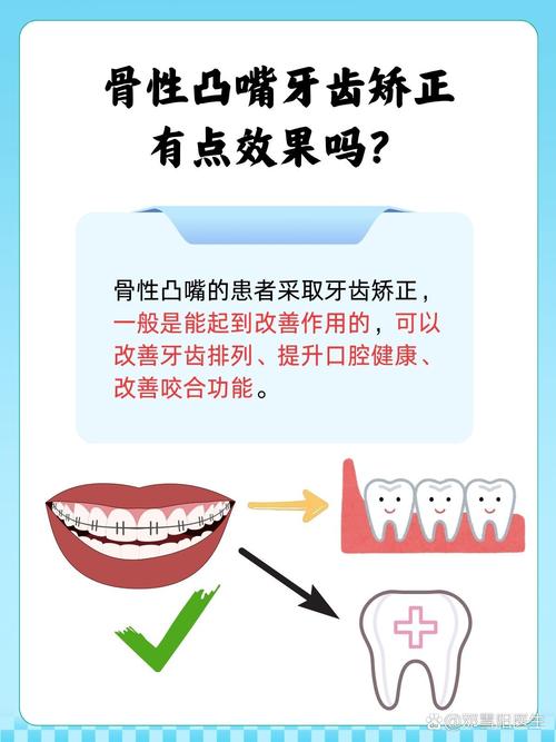 牙齿骨性突出怎么矫正?有哪些有效方法?-图2 牙齿骨性突出怎么矫正?有哪些有效方法?-图2