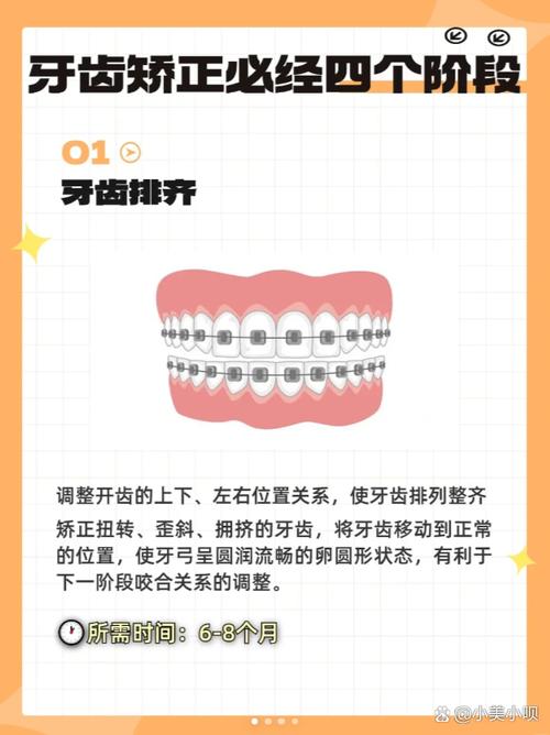 上排牙齿突出怎么矫正？有哪些科学有效的矫正方法？-图1