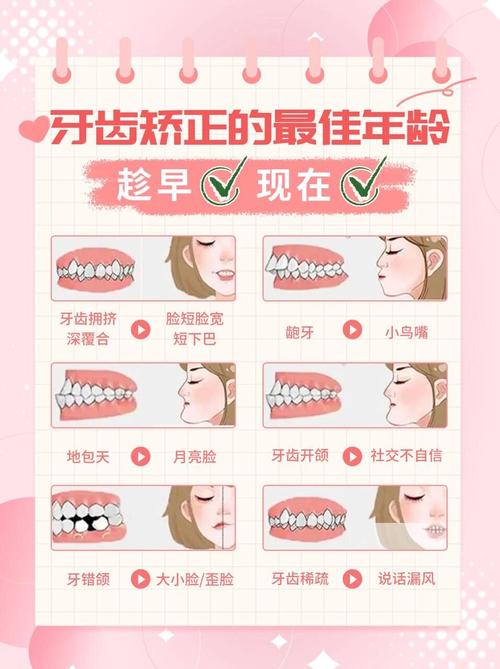 牙齿矫正最佳时间是什么时候？-图3