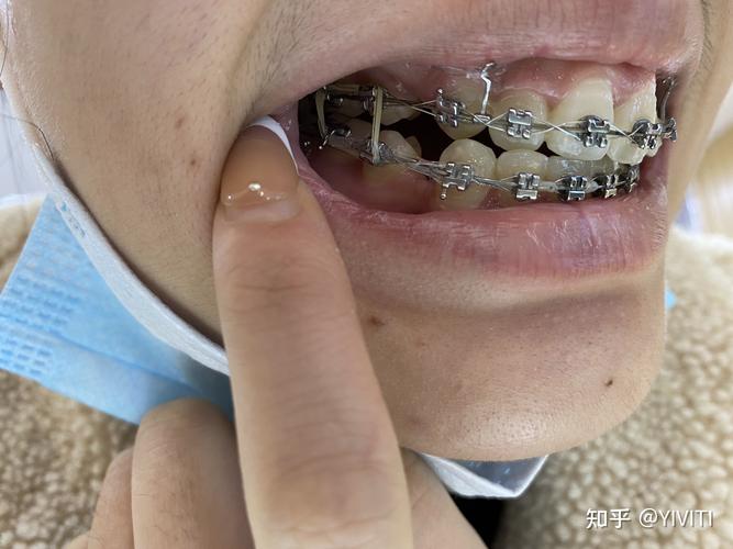 上海治疗牙齿矫正哪好-图2