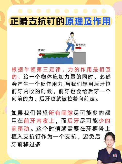 牙齿矫正种植钉是什么？矫正牙齿的关键工具？-图2