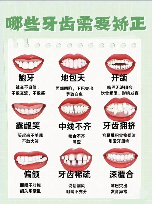 哪些情况不适合矫正牙齿？这些禁忌你必须提前了解清楚-图1