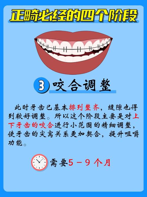 21岁牙齿矫正要多久-图1