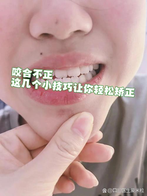 牙齿咬合不齐矫正方法-图2