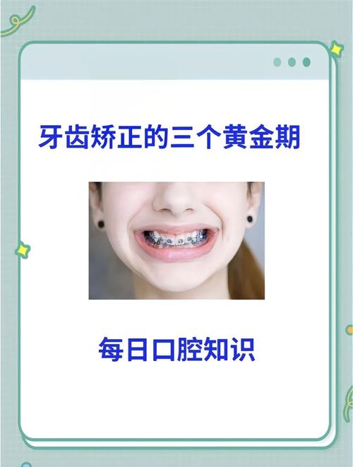 13岁矫正牙齿一般需要多长时间?-图3 13岁矫正牙齿一般需要多长时间?-图3