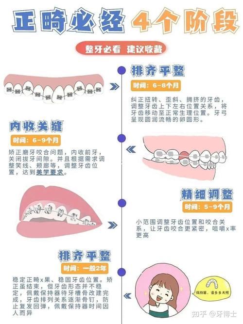 牙齿矫正一般需要多久才能看到明显效果？-图3