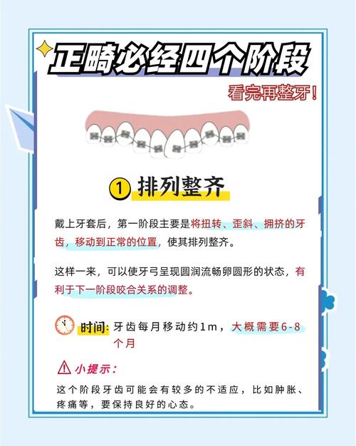 19岁矫正牙齿要多久-图2 19岁矫正牙齿要多久-图2