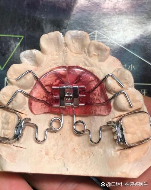 南通牙齿矫正哪家好？求推荐靠谱机构！-图2